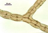 5 – Dettaglio dei filamenti della fase tetrasporofitica